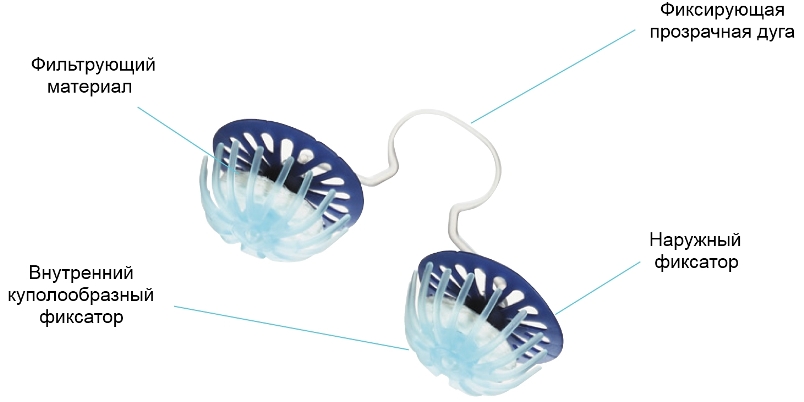 Фото: Фильтр для носа