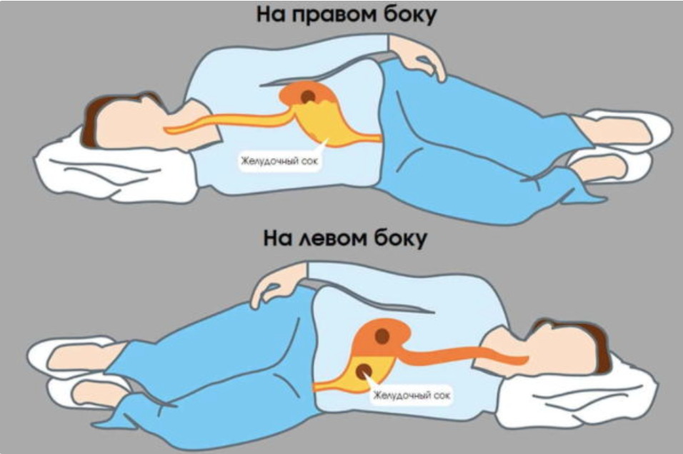 Почему нужно спать на левом боку?