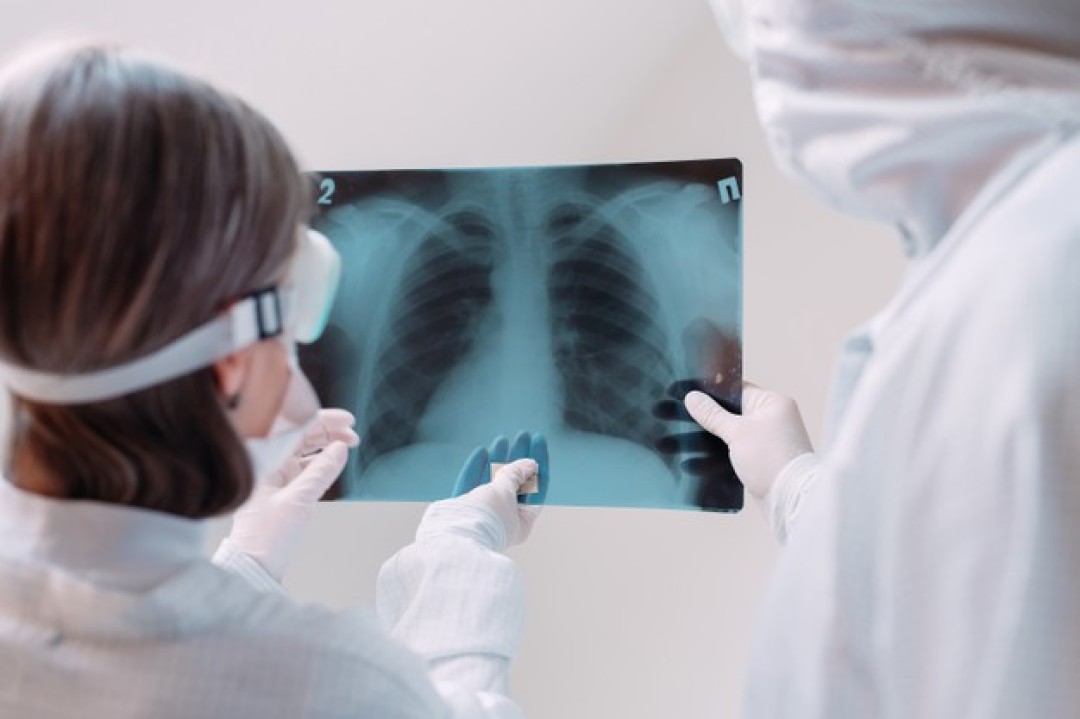 В Узбекистан вернулась пневмония: выявили новых инфицированных — статистика