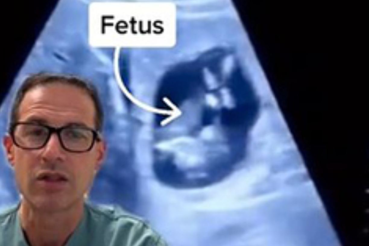 Врач обнаружил у беременной пациентки ребенка в печени 