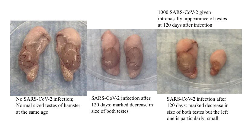 Тестикулы здоровых хомяков (слева) и разные варианты повреждения яичек при ковиде. (Фото: Журнал НОЖ)