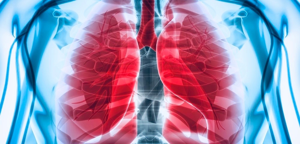 За прошедшие сутки в Узбекистане более ста человек заразились пневмонией