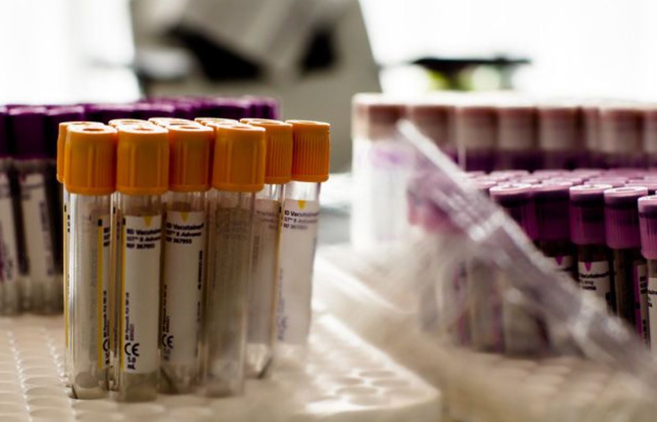 Женщина излечилась от ВИЧ благодаря «мутантной» крови младенца