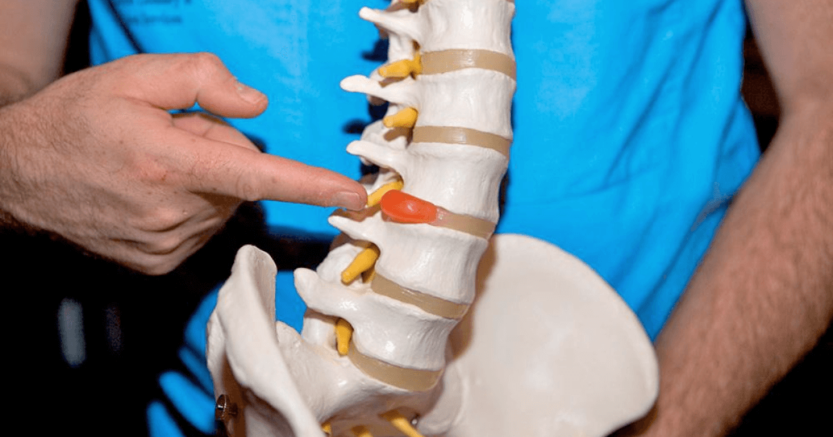 Что можно и что нельзя делать при межпозвоночной грыже? Рассказывает эксперт из Узбекистана