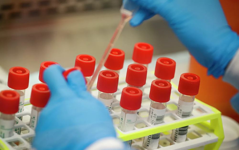 Американские ученые обнаружили биомаркер, способный предсказать тяжесть течения COVID-19