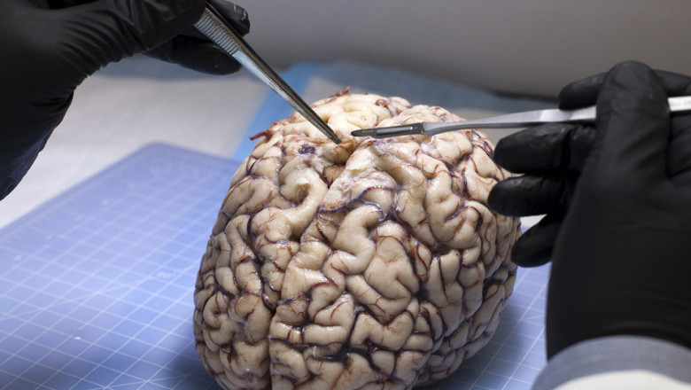 Найден главный фактор долголетия мозга