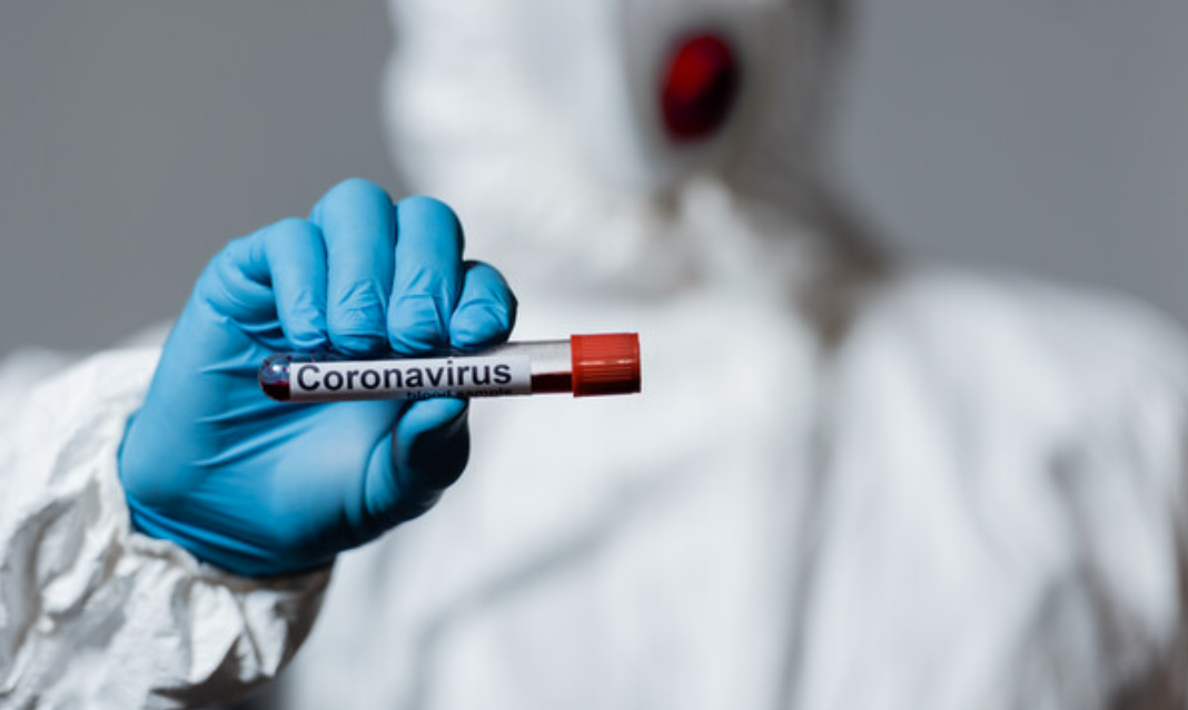 Штамм «лямбда» уже распространен в более 30 странах мира