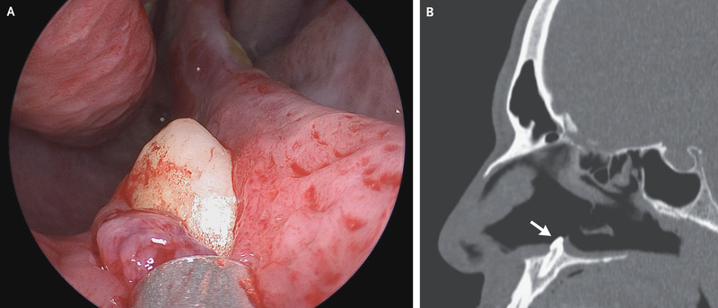 Cнимки, которые были сделаны во время обследования пациента. Фото:&nbsp;nejm.org