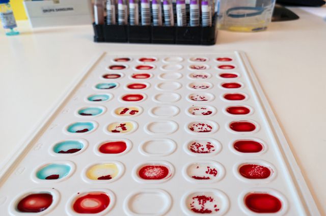 Что такое «жирная» кровь и о чем она может говорить?