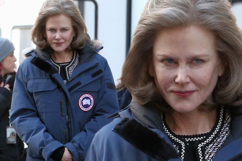 Фанаты Николь Кидман шокированы постаревшим лицом актрисы