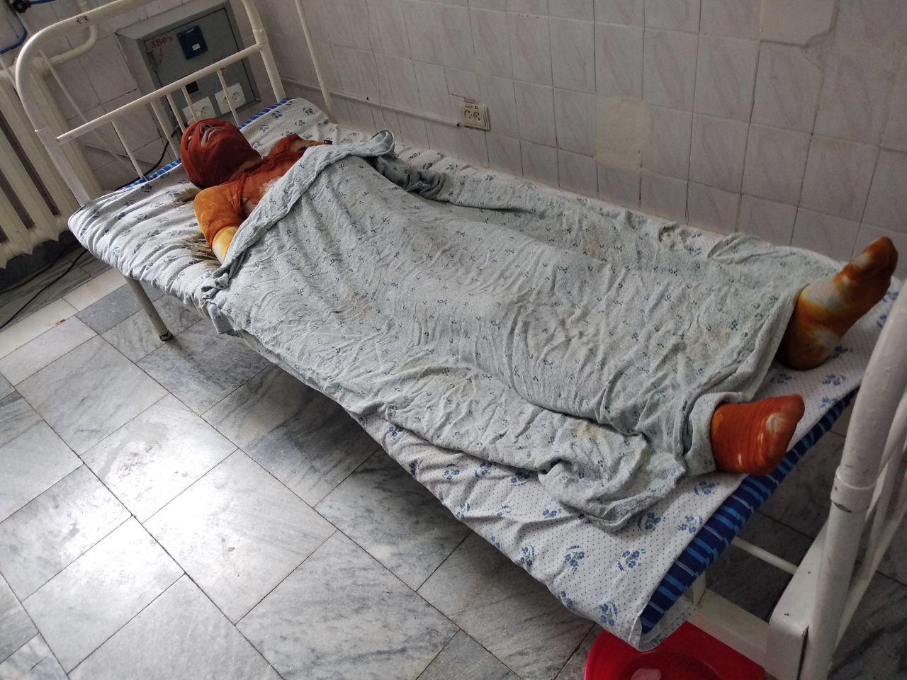 В Андижане мужчина хотел попариться в бане и обгорел