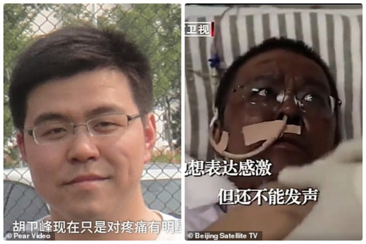 Китайские врачи почернели из-за коронавируса