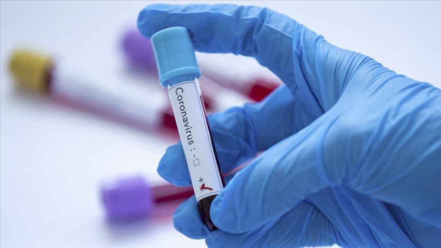 В Ташкенте выявили новые случаи заражения коронавирусом