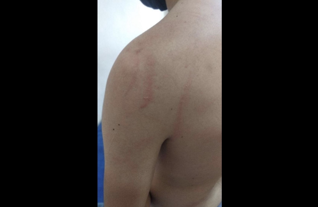 Нацгвардейцы пытались задушить жителя Сурхандарьи за отсутствие маски