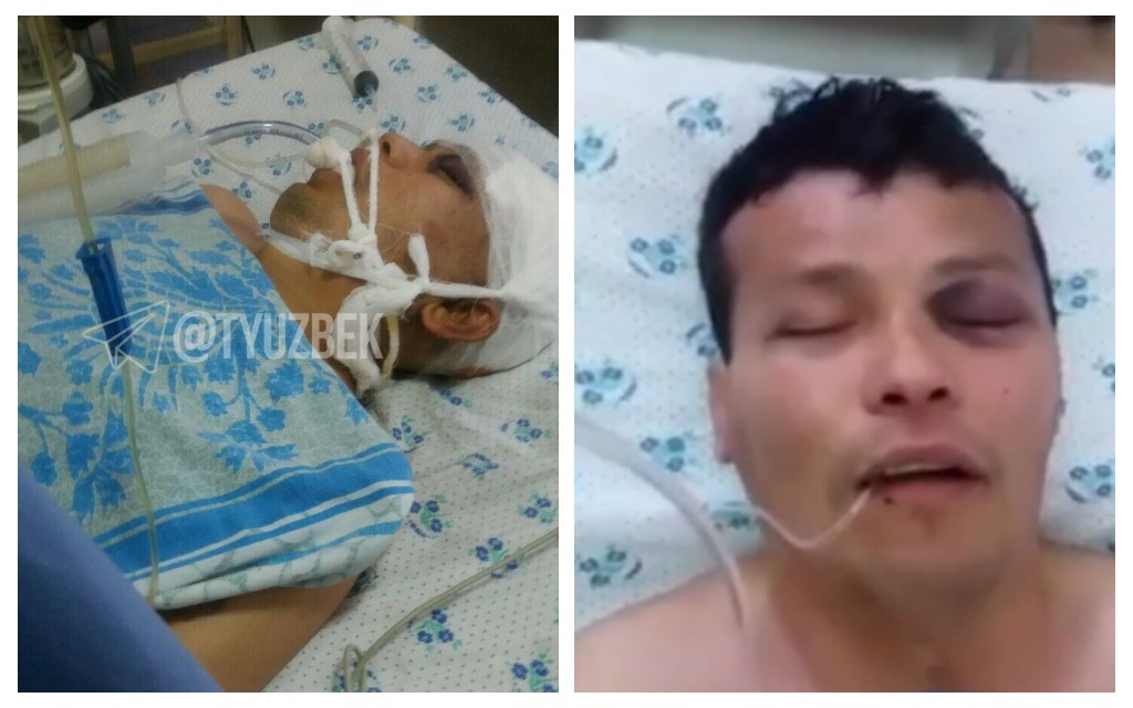 «Изо рта текла пена, тело было окровавлено» — сестра скончавшегося из-за пыток андижанца рассказала о смерти своего брата