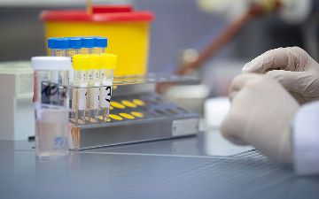 Акилов заявил, что все регионы в достаточном количестве обеспечены тестами на коронавирус