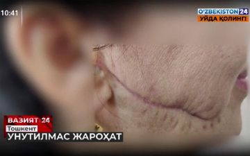 В Ташкенте мужчина порезал лицо и руку своей жены лезвием во время ссоры и получил срок