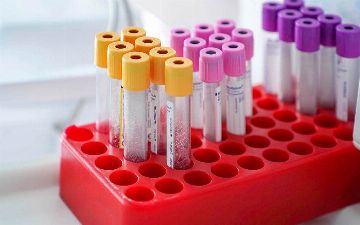 Российский эксперт заявил, что около 20% перенесших коронавирус теряют антитела через пару месяцев