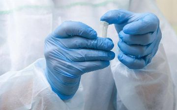 В России впервые зафиксировали заражение человека птичьим гриппом H5N8