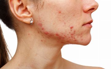 Узбекский нутрициолог рассказала о секретах здоровой кожи 