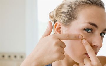 Названы продукты, вызывающие прыщи