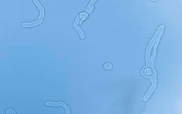 Узбекский терапевт рассказала, почему появляются мушки перед глазами