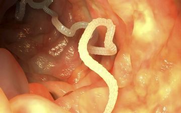 Узбекский врач рассказал, как и какие паразиты могут жить в вашем организме