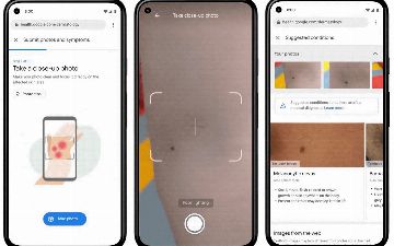 Теперь через Google можно идентифицировать ваши кожные заболевания