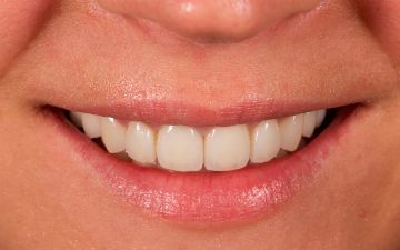 Узбекский терапевт рассказала, почему во время беременности крошатся зубы