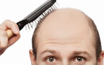 Ты начал лысеть: почему мужчинам и женщинам нужно по-разному бороться с облысением