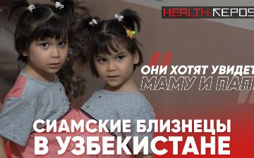 Сиамские близнецы в Узбекистане: как живут неразлучные сестры