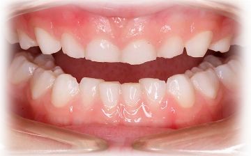 Малика Маматова рассказала, почему зубы мудрости прорезываются не у всех