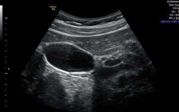  Узбекский специалист рассказала о том, как проявляется застой желчи