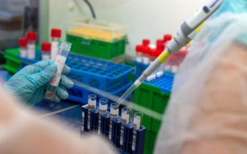 Чем отличается Дельта вариант коронавируса от «классического»?