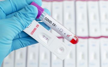 Специалист назвал срок иммунитета у переболевших COVID-19