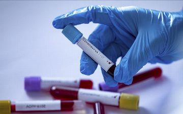 У 496 человек выявлен коронавирус, 3 пациента скончались: Минздрав опубликовал статистику по зараженным «короной» в Узбекистане