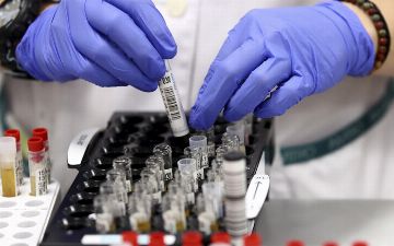 Вирусолог назвал условие для формирования иммунитета к штамму «дельта»