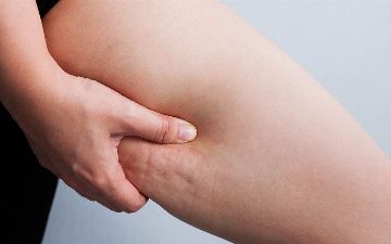 Как бороться с целлюлитом?