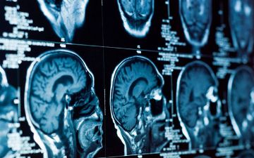 Ученые из России разработали датчик, который поможет исследовать мозг человека