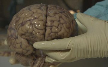 Мозг, который вырастили в пробирке, начал видеть