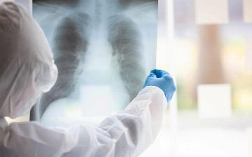 Узбекистанцы продолжают заражаться пневмонией — статистика
