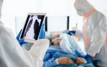 В Узбекистане за прошедшие сутки выявили 303 случая заражения пневмонией 