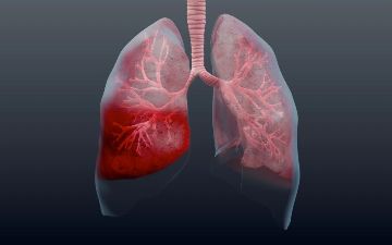 Ситуация с пневмонией в Узбекистане улучшилась — статистика