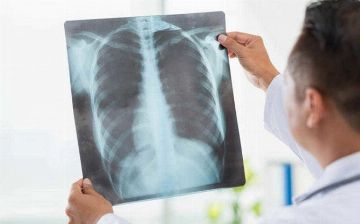 Количество зараженных пневмонией в Узбекистане идет на спад — статистика