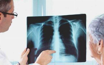 В Узбекистане за прошедшие сутки от пневмонии скончались два человека — статистика