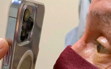 Врач стал использовать камеру на iPhone, вместо микроскопа, для лечения пациентов