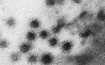 Узнайте, как выглядит дельта-штамм коронавируса — фото