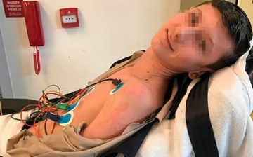 Подросток смог выжить после удара молнии благодаря своей обуви