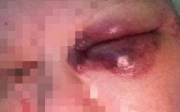 В Ташкенте молодой парень избил и домогался 63-летней женщины