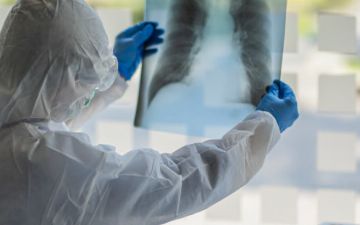 Впервые за долгое время в Узбекистане не было выявлено случаев инфицирования пневмонией — статистика